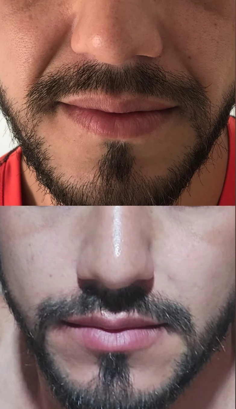 Imagem Bigode Chines 1