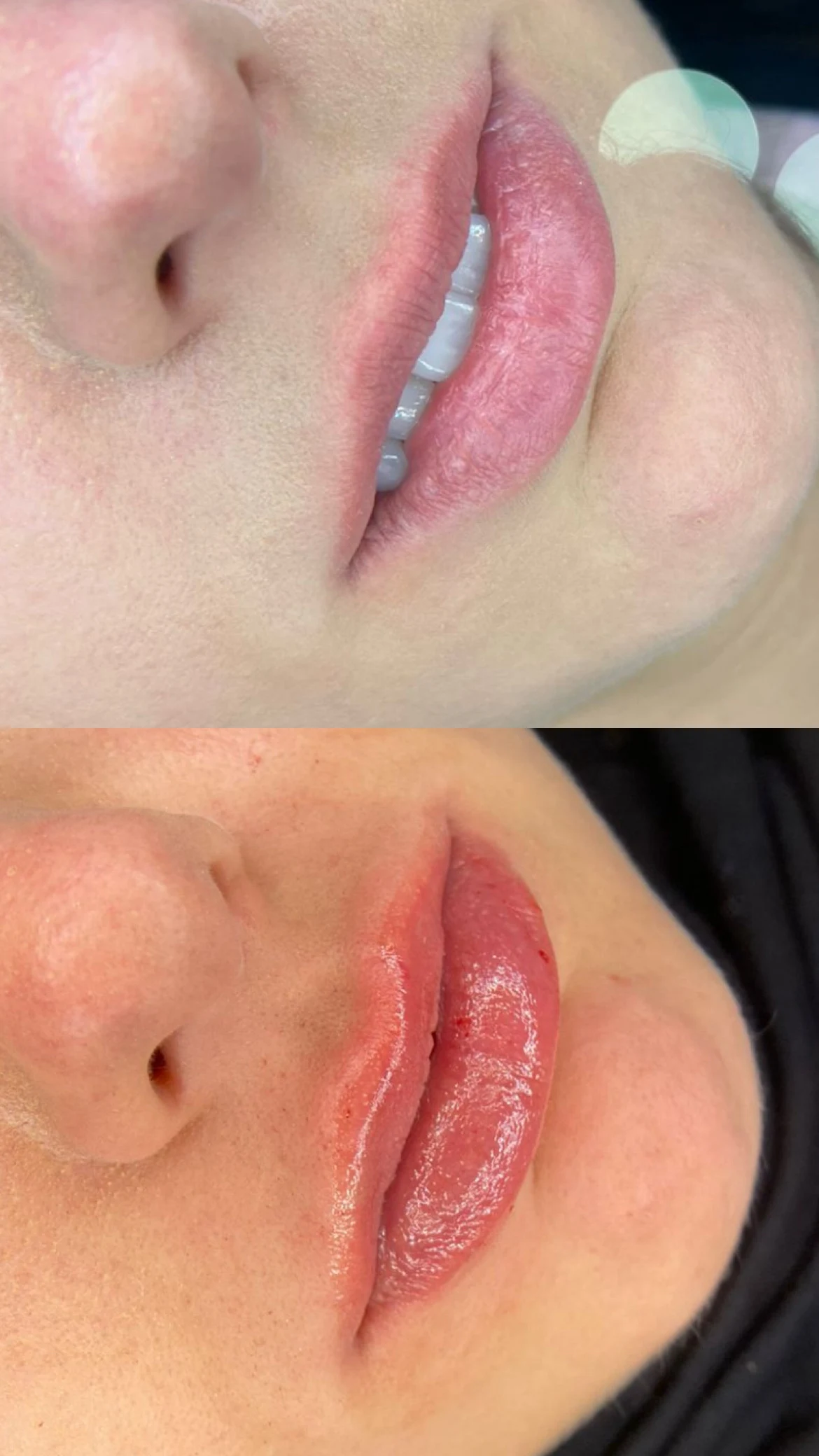 Imagem Labial 2