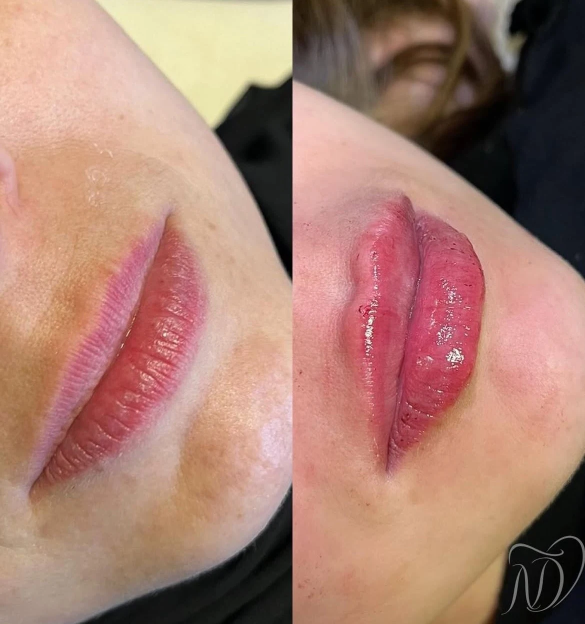 Imagem Labial 3
